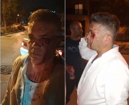 Son Dakika... Bursa'da İYİ Partili Meclis üyesine saldırı