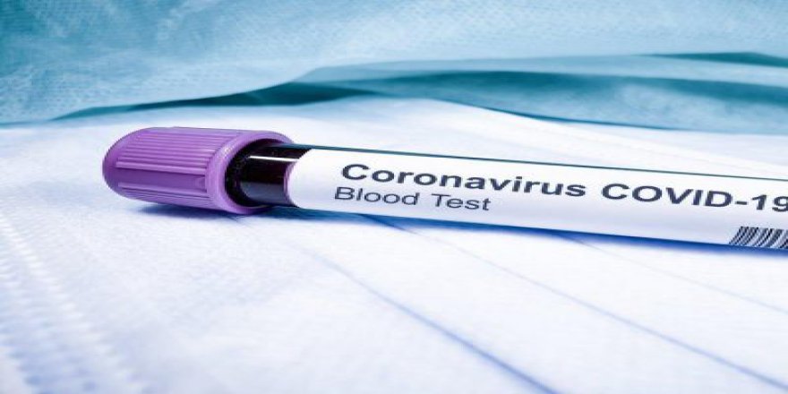 Koronavirüs'e iyi gelen ilaçlar açıklandı!