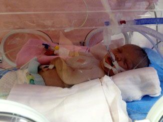 Muhammet Can bebeğe 16 ayda 6 ameliyat