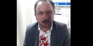 Bursa’da istifa etmeyen sendika başkanına Ülkü Ocakları'nda dayak!