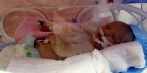 Muhammet Can bebeğe 16 ayda 6 ameliyat