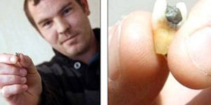 Sosisten diş, ekmekten kanlı şırınga çıktı