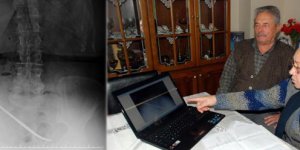 Karnında makasla 3 ay yaşadı!